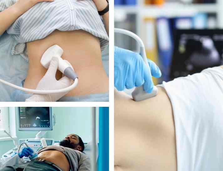 Why Choose Sugarline Health Care for Your Fibroscan?