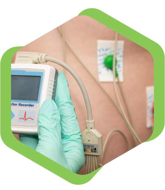 Holter Monitor Test in Kolkata