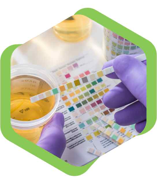 Uroflowmetry Test in Kolkata