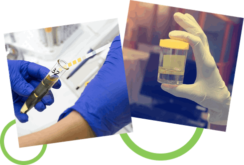 How Does the Uroflowmetry Test in Naktala Work?