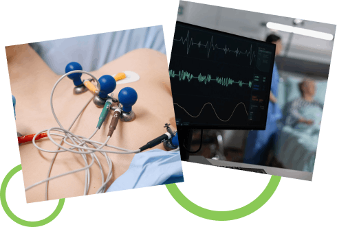 How the ECG Test Works