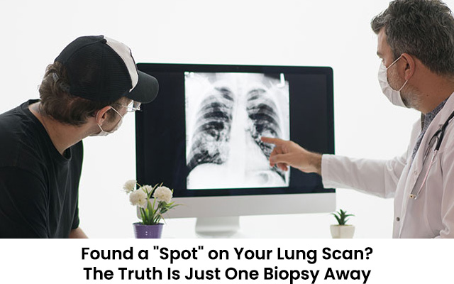 Found a “Spot” on Your Lung Scan? The Truth Is Just One Biopsy Away