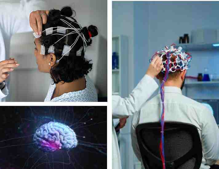 Why Choose Sugarline Health Care for Your EEG?